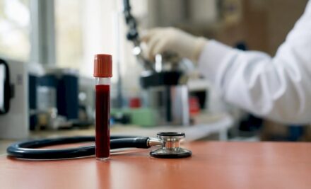 Your Cholesterol Numbers Explained: What Each One Means