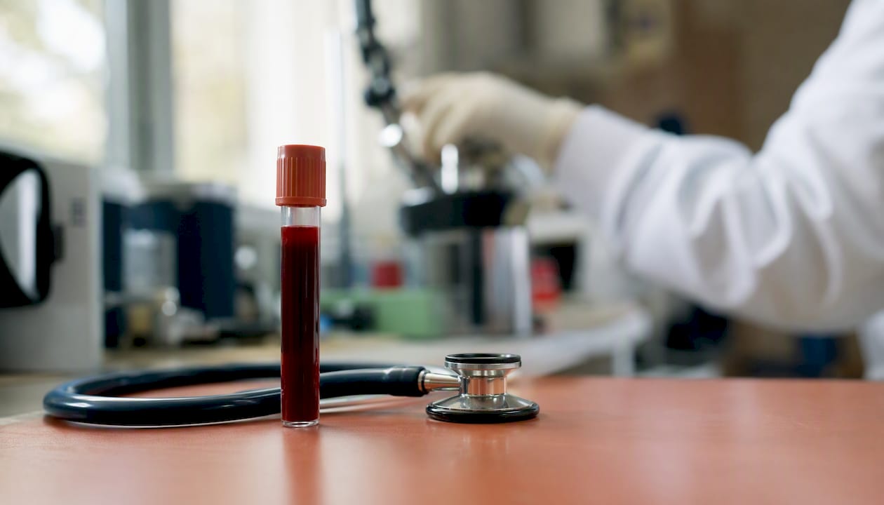 Your Cholesterol Numbers Explained: What Each One Means